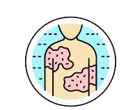 Urticaria icon